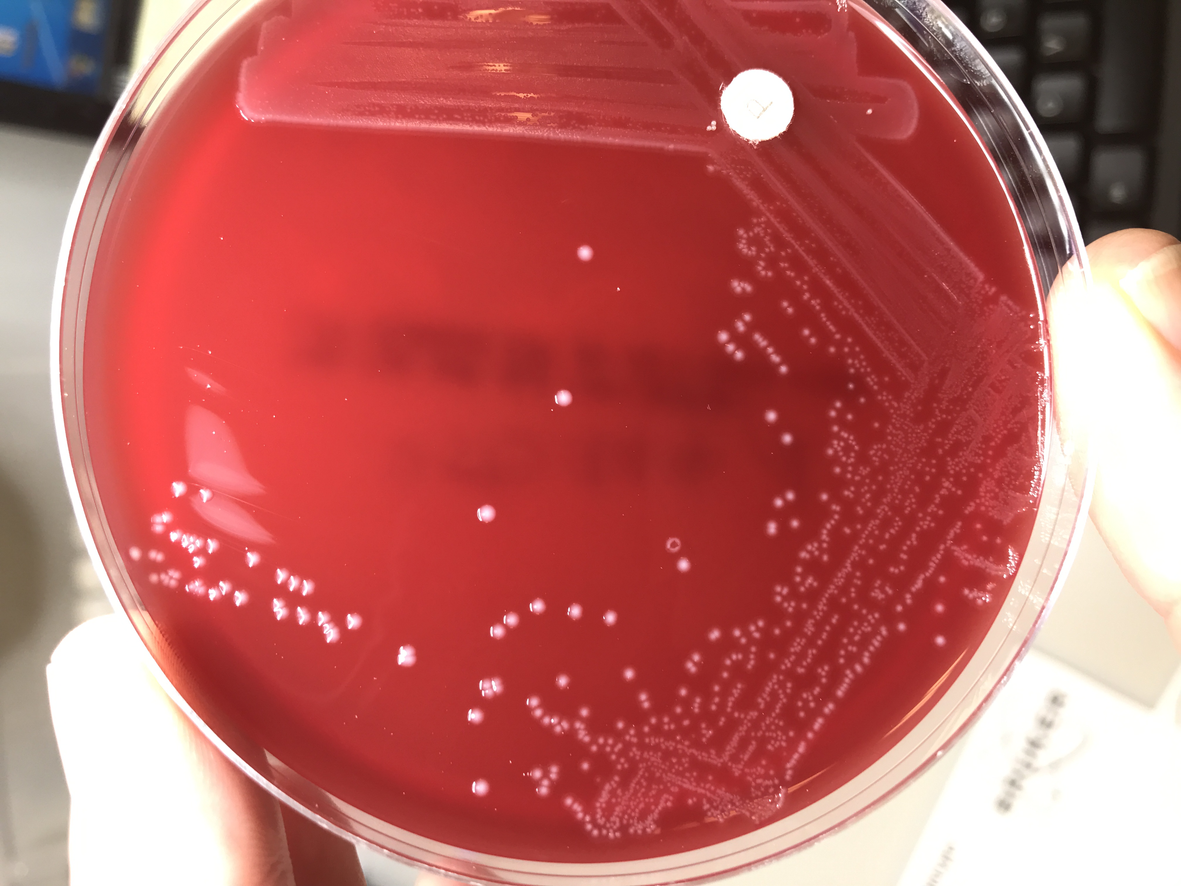 Podcast calls for data about rare disease linked with raw freshwater